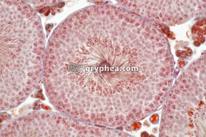 Testicule avec tube séminifère en CT x100 - gryphea.com